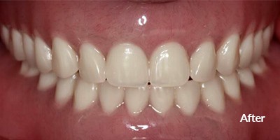 beautiful teeth